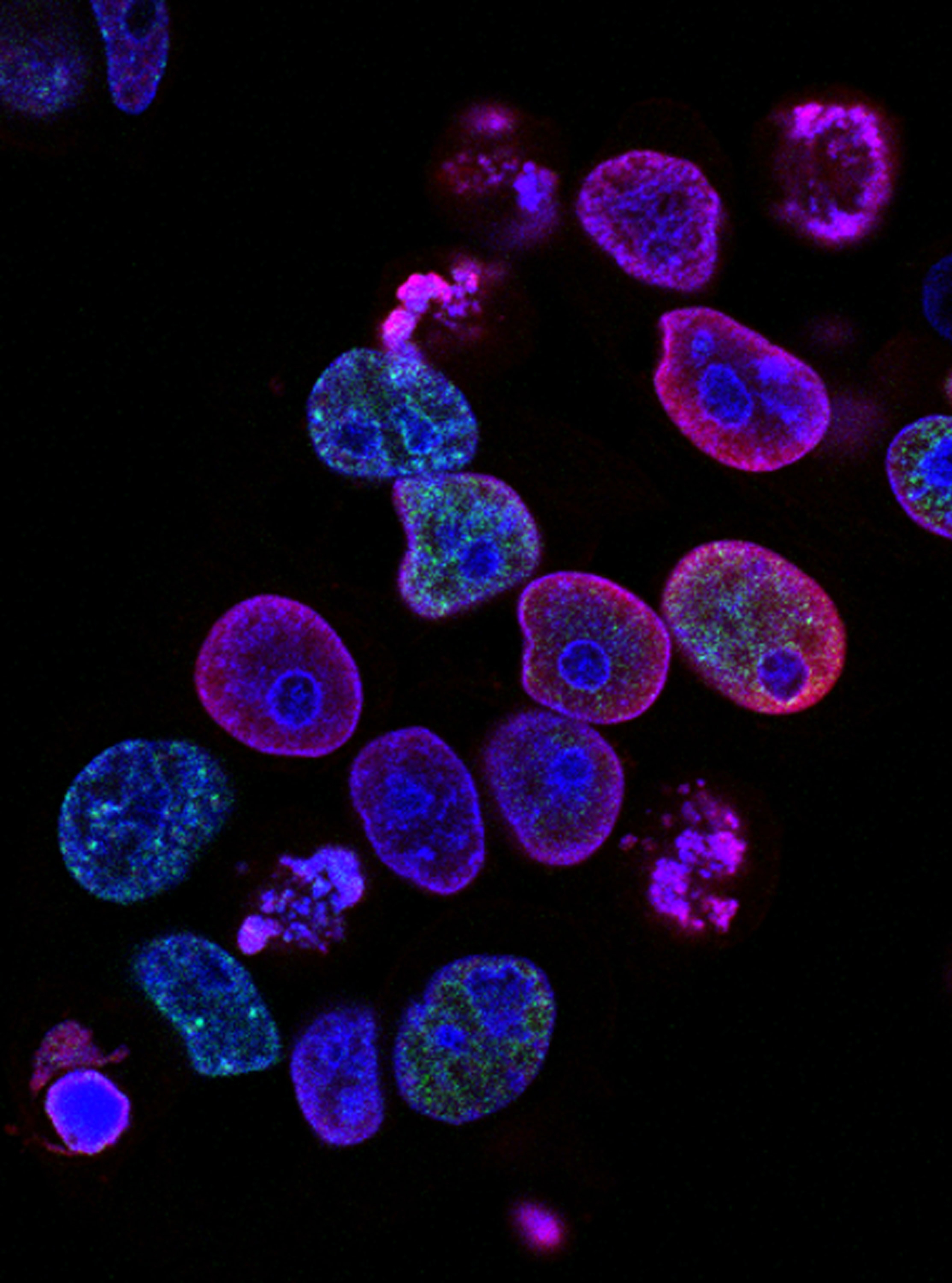 Colorectal cancer cells