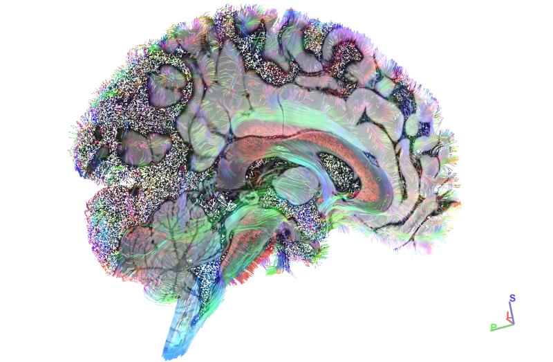 a brain scan.