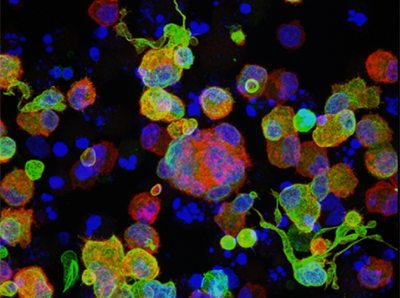 Image of in vitro differentiated megakaryoblastic cells stained for CD41 (red), TUBB1 (green), and DNA (blue)