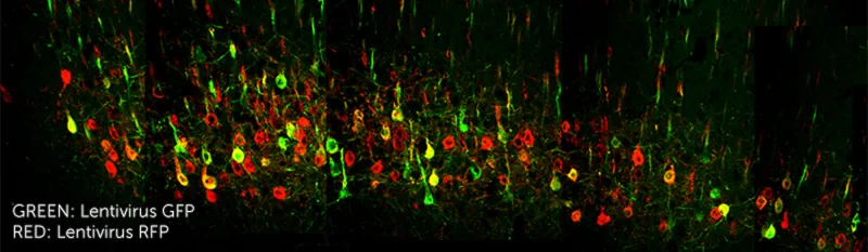 colored dots that represent lentivirus GFP (green) and Lentivirus RFP (red)