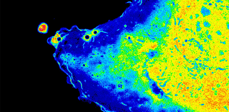 descriptive image of live microscopic image of an Airyscan confocal.