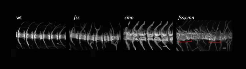 four different spine patterns in a row: wt, fss, cmn, and fss;cmn