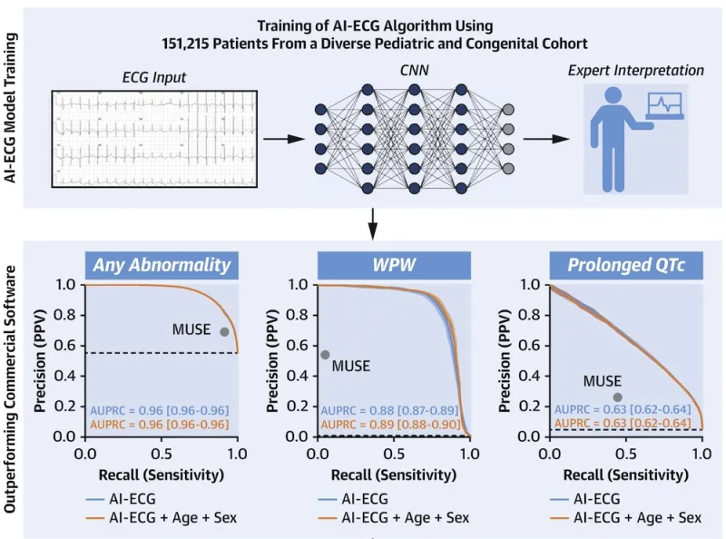 AI-ECG model training process and outperforming commercial software