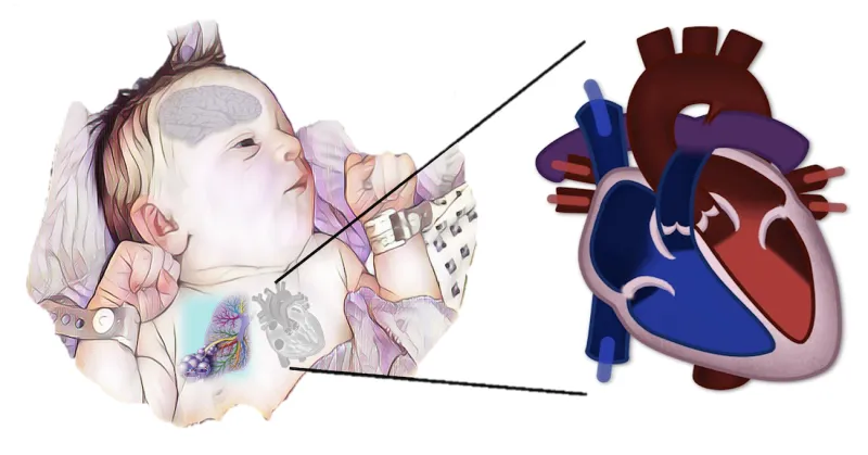 A baby lying down with a enlarged illustration of its heart showing the different chambers and valves