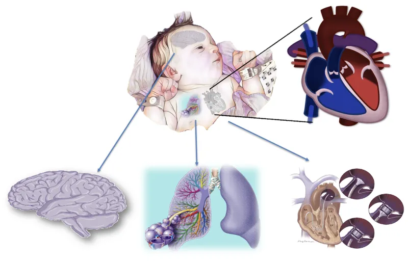 Illustration of a baby showing enlarged views of the brain, lungs, and heart