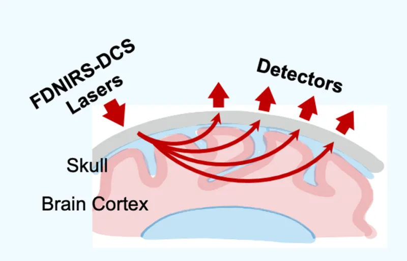 Illustration of the brain cortex and skull while FDNIRS-DCS Lasers go through the skull and back out to to the detectors
