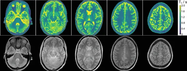 Ten brain MRI images