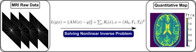 Info graphic of MRI raw data and solvina a nonlinear inverse problem to get a quantitative map of the brain
