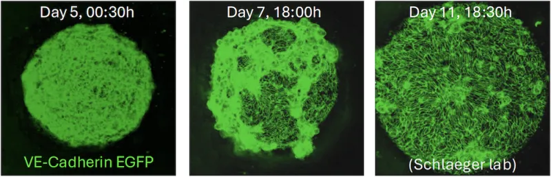 Three time-lapse confocal imaging of embryoid bodies on days 5, 7 and 11.