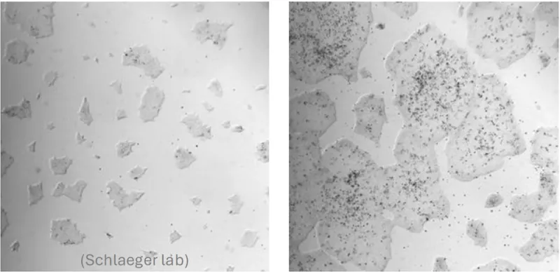 Two images of hiPSC cultures