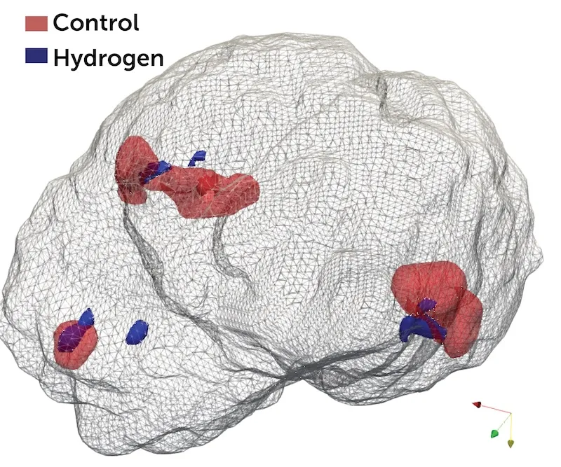 Brain show damage after an injury with a control substance vs hydrogen