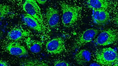 multiple ECFC cells