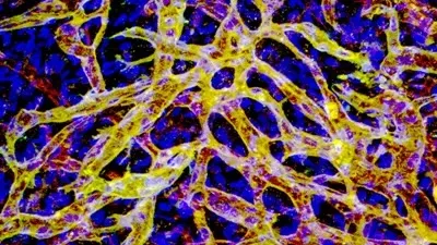 vascular artery networks