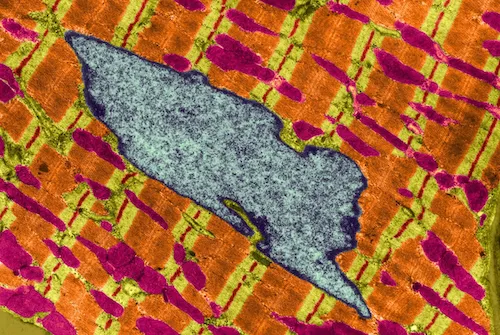 Mitochondria and a transmitted electron micrograph in a heart muscle
