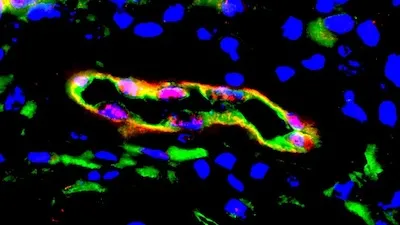 genetically engineered vascular cells