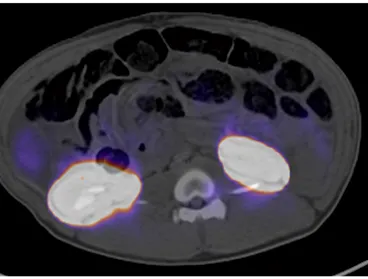scan of kidneys