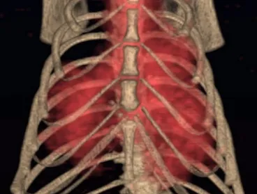 Human ribcage