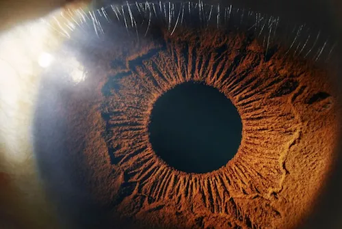 Human eye