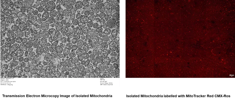 A slide of transmission electron microcopy image of isolated mitochondria and another slide of isolated mitochondria labelled with MitoTracker red CMX-Ros