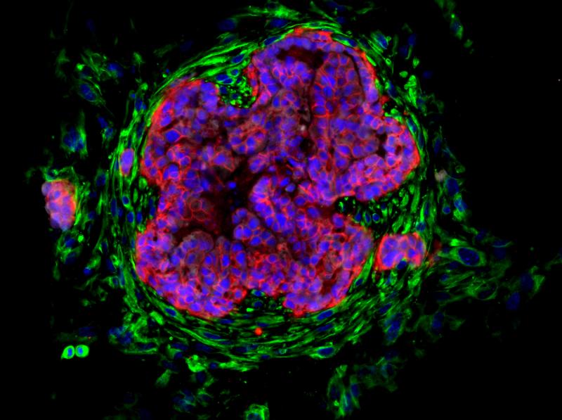 purple and green round cell