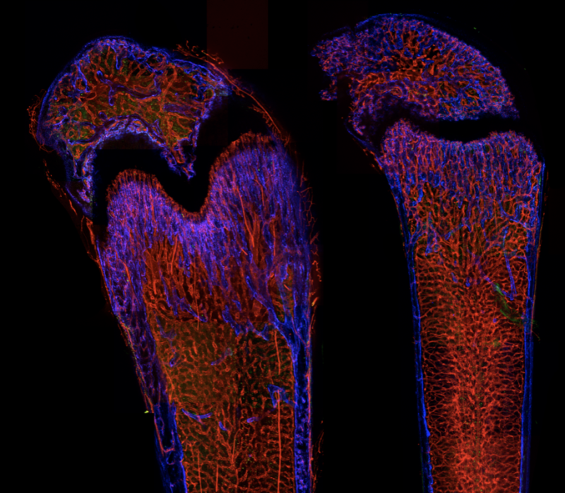 microscopic t-cells.