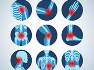 nine circle showing xrays of areas of chronic pain on the body