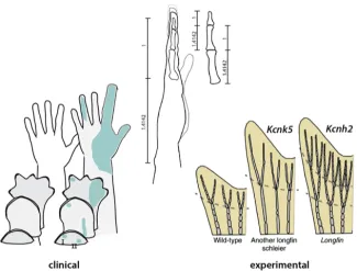 hand and limb proportions.