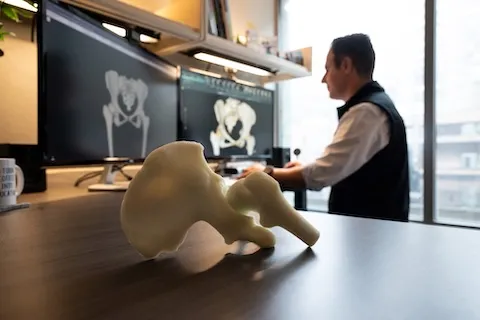 A hip bone on a table with a male doctor looking at bone scans on two computer screens