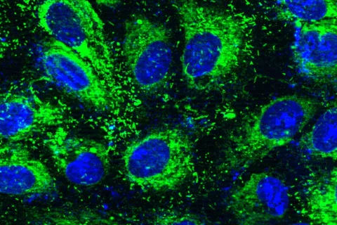 Multiple cells